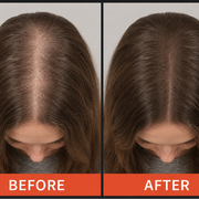 650nm Laser Hair Growth Comb for Thinning Hair