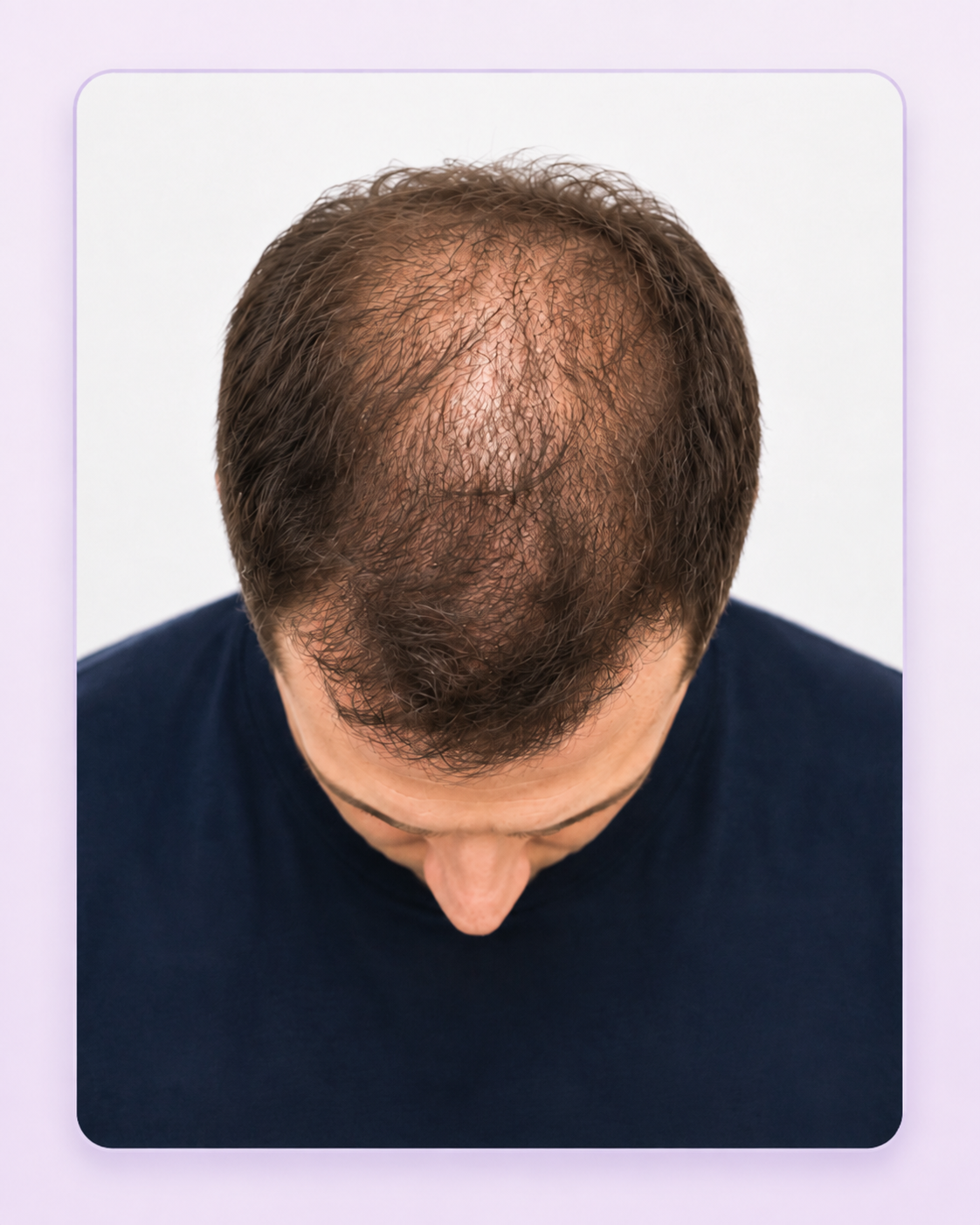 Before image
